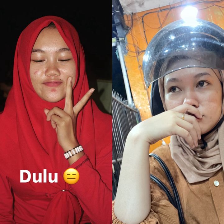 cewebugis__