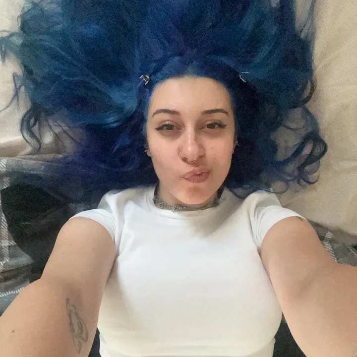 yukselenimkedi