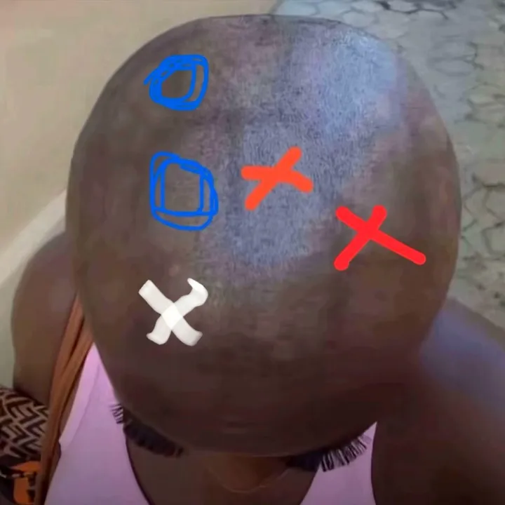bald_head_girl