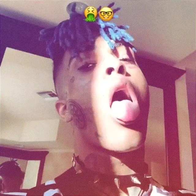 chestxpain