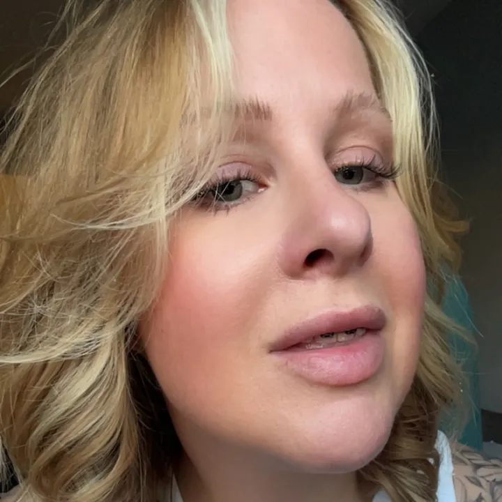 adultbraces4