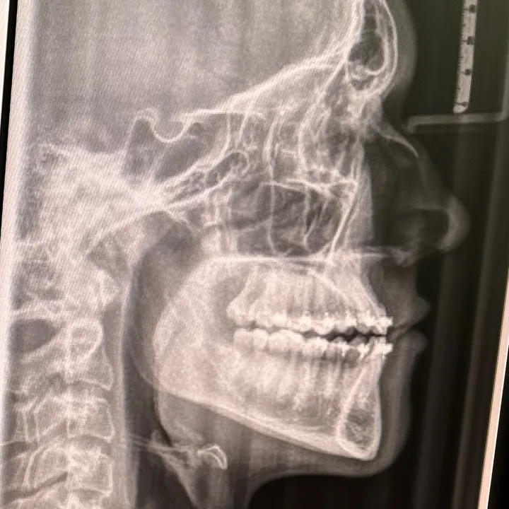 just.a.rat.maxilla