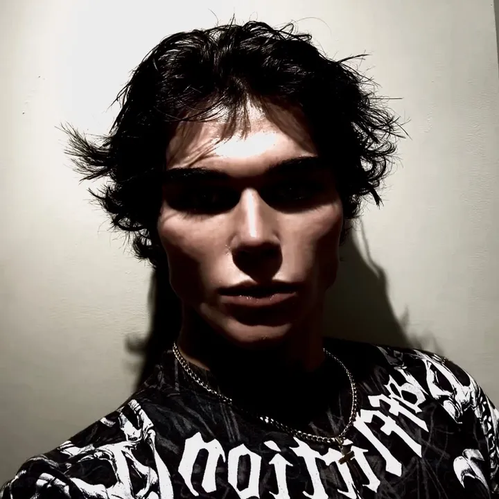 zygomatic_excellence